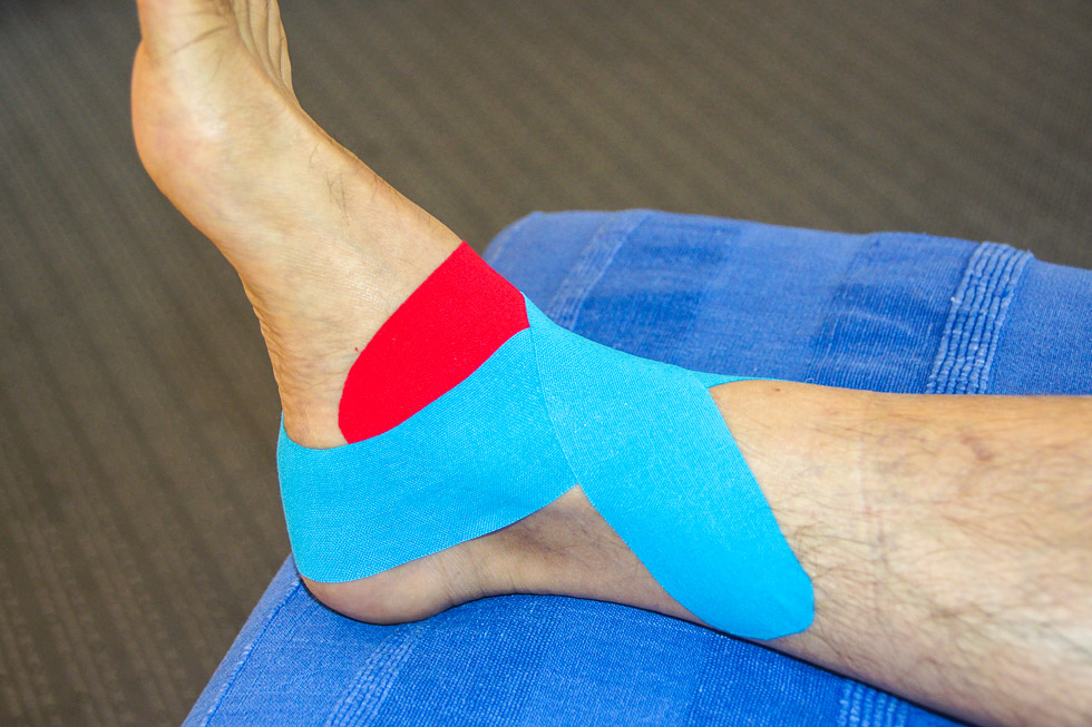 Kinesio-Taping